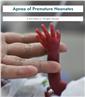 Apnea of Premature Neonates